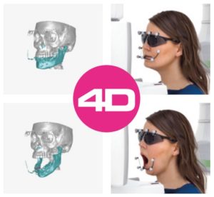 4D jaw motion