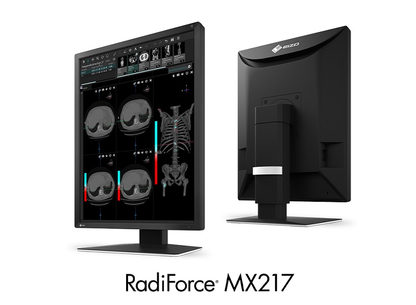 Monitor medyczny Eizo MX217